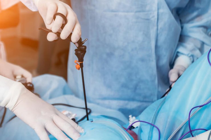 Gynecology Surgeries